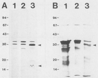 https://cdn.ncbi.nlm.nih.gov/pmc/blobs/3840/259828/3029f1fc0cff/iai00071-0132-b.jpg