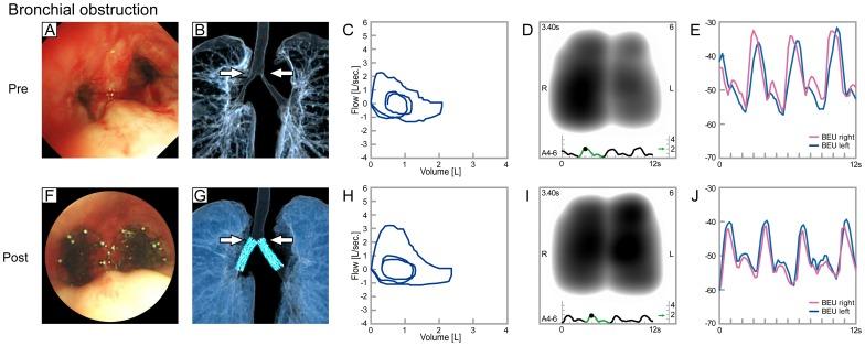 https://cdn.ncbi.nlm.nih.gov/pmc/blobs/384b/4136828/0dd32b033066/pone.0105327.g004.jpg