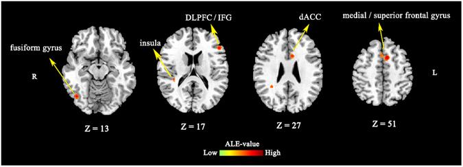 https://cdn.ncbi.nlm.nih.gov/pmc/blobs/3859/5437037/6d2cb05d497f/41598_2017_2266_Fig1_HTML.jpg