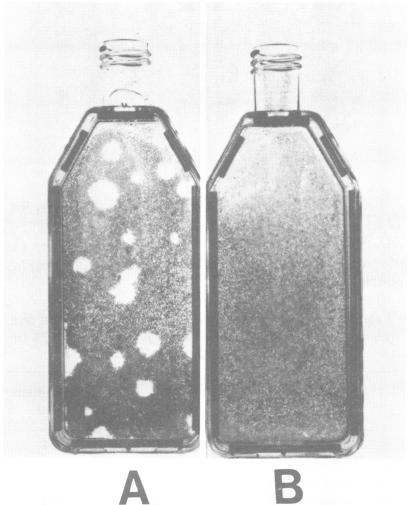 https://cdn.ncbi.nlm.nih.gov/pmc/blobs/385d/273232/1cc7668ddee5/jcm00184-0022-a.jpg