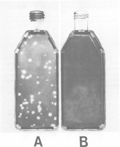 https://cdn.ncbi.nlm.nih.gov/pmc/blobs/385d/273232/a83288a9865f/jcm00184-0021-a.jpg