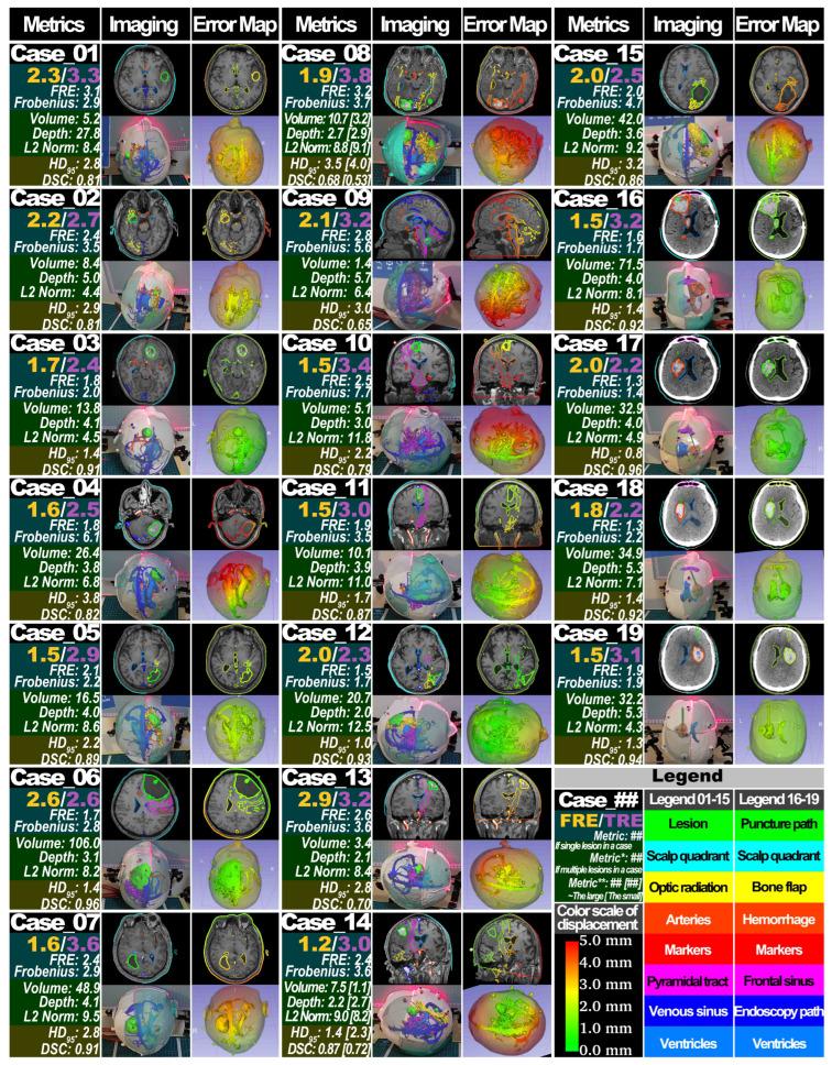 https://cdn.ncbi.nlm.nih.gov/pmc/blobs/3872/10857152/a84181a2e10a/sensors-24-00896-g008.jpg