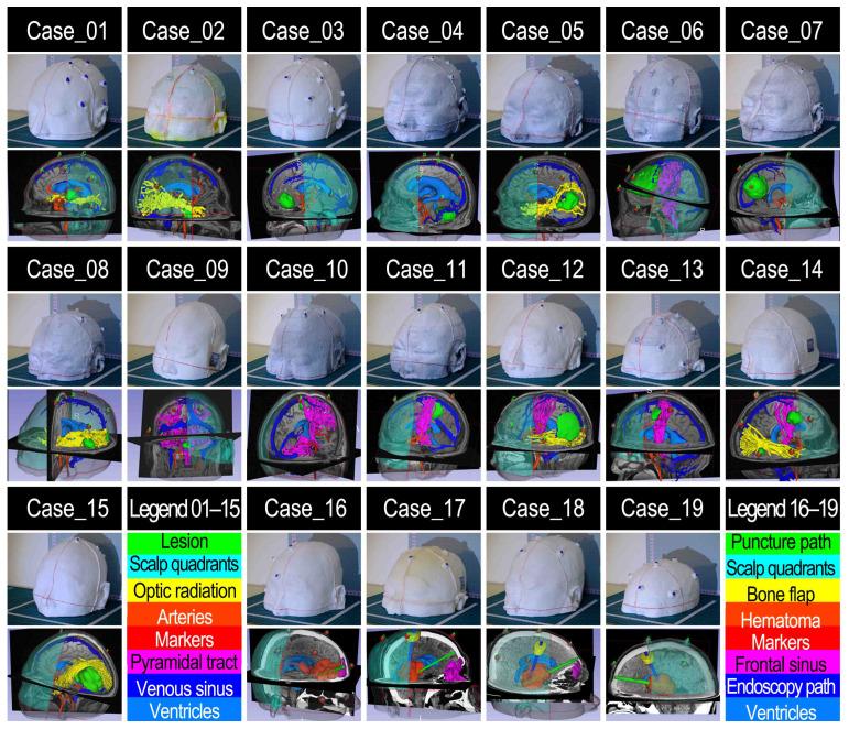 https://cdn.ncbi.nlm.nih.gov/pmc/blobs/3872/10857152/ad7059e01620/sensors-24-00896-g007.jpg