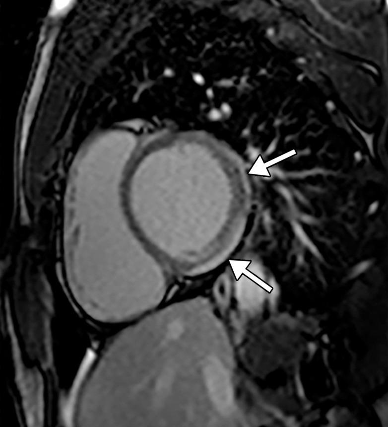 https://cdn.ncbi.nlm.nih.gov/pmc/blobs/3872/7646410/0a1690225155/rg.2020200195.fig3c.jpg