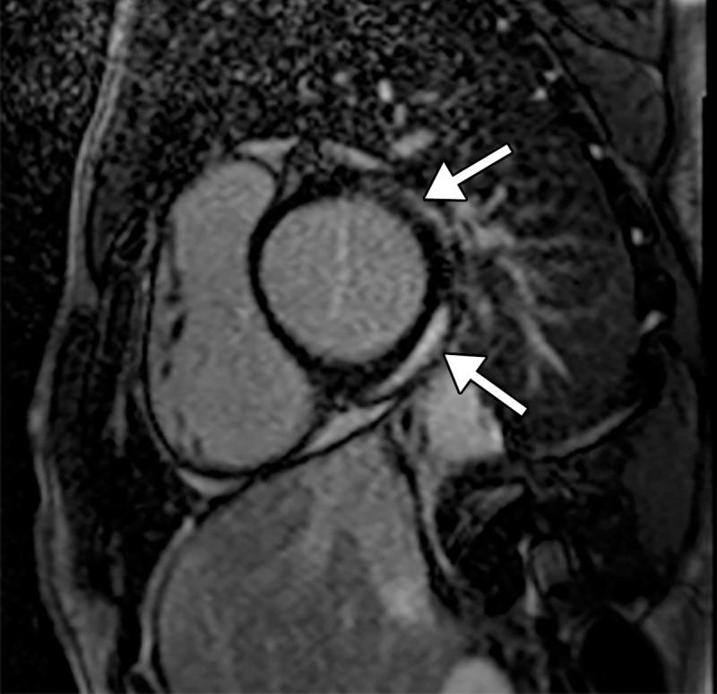 https://cdn.ncbi.nlm.nih.gov/pmc/blobs/3872/7646410/22cae8aed8aa/rg.2020200195.fig3d.jpg