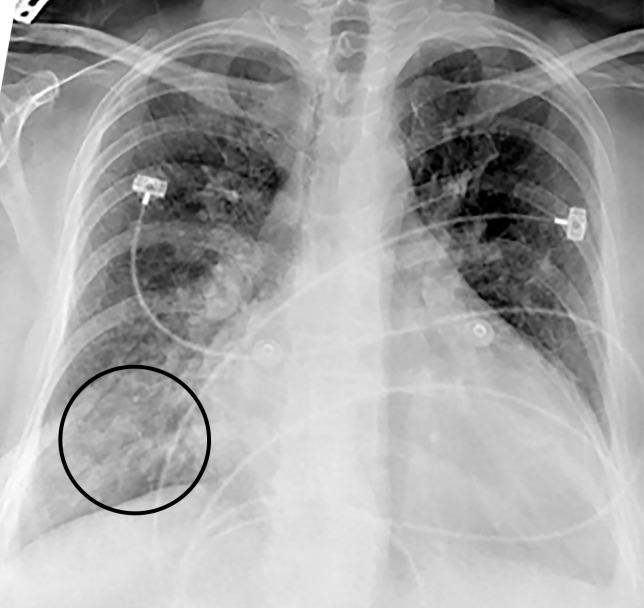 https://cdn.ncbi.nlm.nih.gov/pmc/blobs/3872/7646410/2a96c2c186b2/rg.2020200195.fig2a.jpg