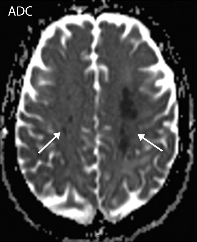 https://cdn.ncbi.nlm.nih.gov/pmc/blobs/3872/7646410/2b9992922dc0/rg.2020200195.fig7d.jpg