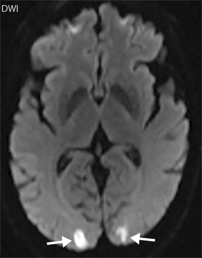https://cdn.ncbi.nlm.nih.gov/pmc/blobs/3872/7646410/50d9cb8172c5/rg.2020200195.fig7e.jpg