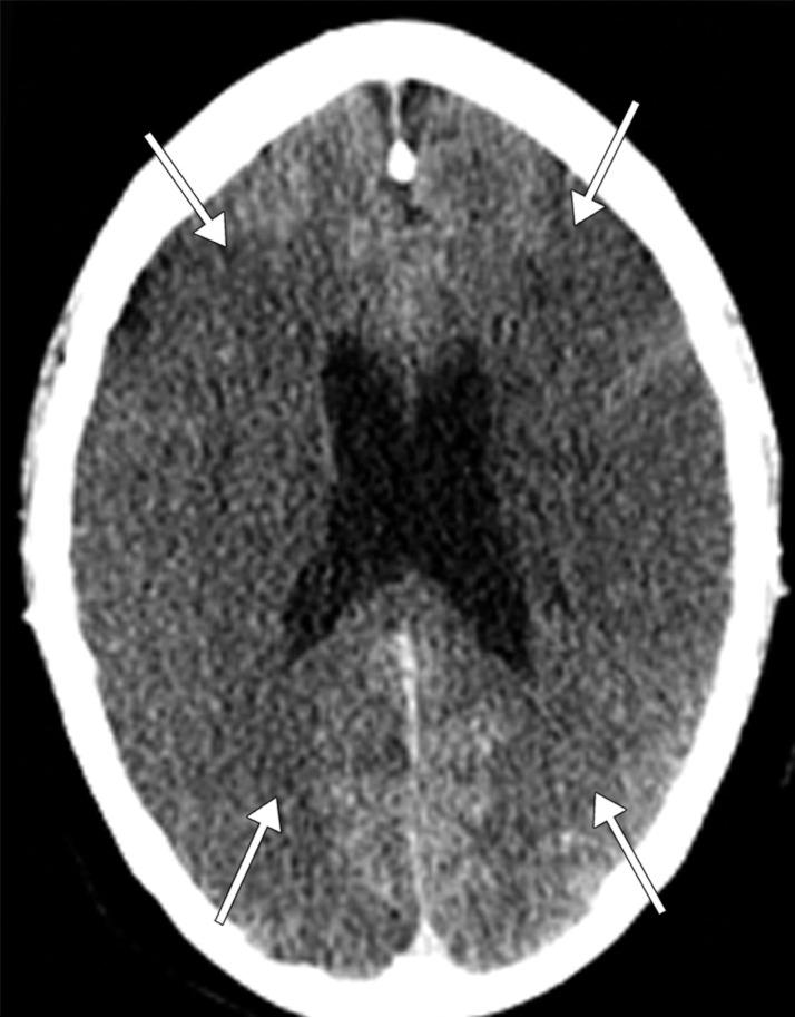https://cdn.ncbi.nlm.nih.gov/pmc/blobs/3872/7646410/5e92ed38548c/rg.2020200195.fig5a.jpg