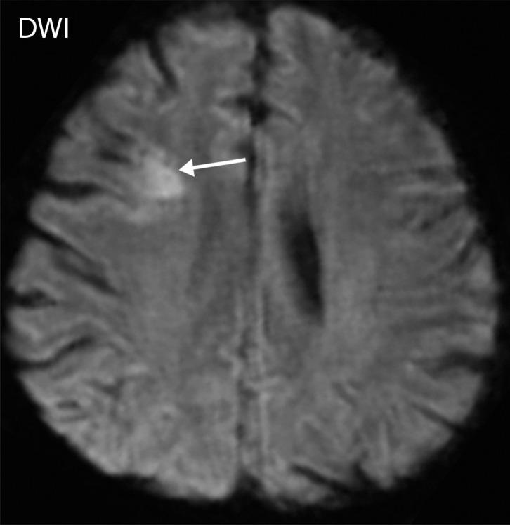 https://cdn.ncbi.nlm.nih.gov/pmc/blobs/3872/7646410/61d5b04cff24/rg.2020200195.fig6b.jpg