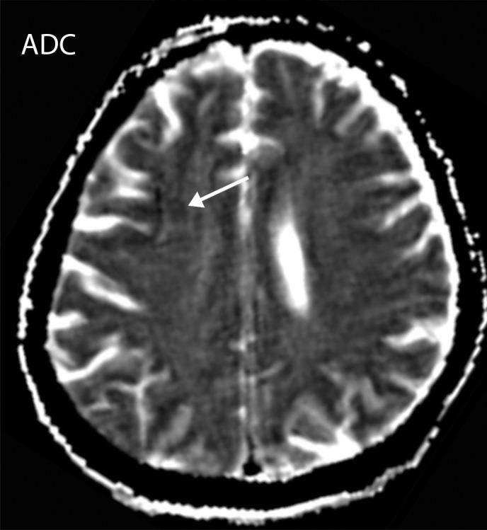 https://cdn.ncbi.nlm.nih.gov/pmc/blobs/3872/7646410/762ac93b3a04/rg.2020200195.fig6c.jpg