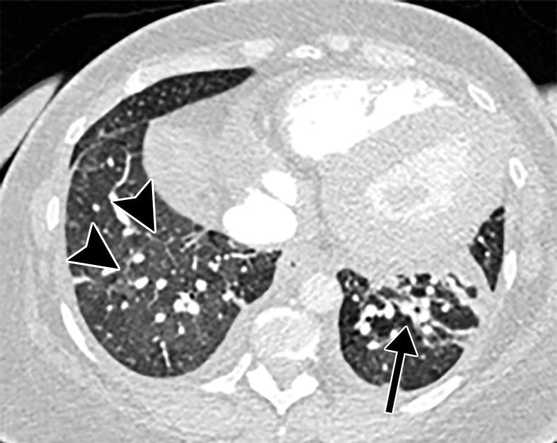 https://cdn.ncbi.nlm.nih.gov/pmc/blobs/3872/7646410/8cce645215bb/rg.2020200195.fig2d.jpg
