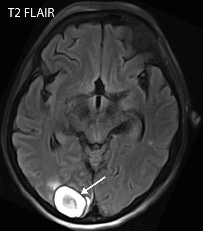 https://cdn.ncbi.nlm.nih.gov/pmc/blobs/3872/7646410/98f4c5a7af1c/rg.2020200195.fig6a.jpg