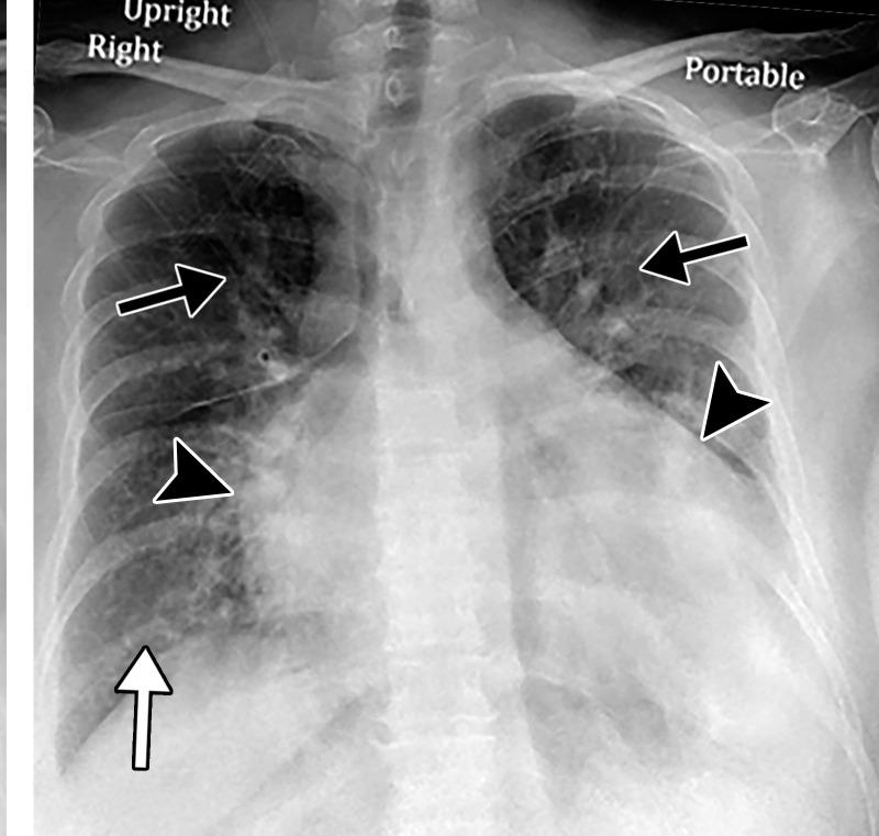 https://cdn.ncbi.nlm.nih.gov/pmc/blobs/3872/7646410/a5f36ee49b84/rg.2020200195.fig2b.jpg