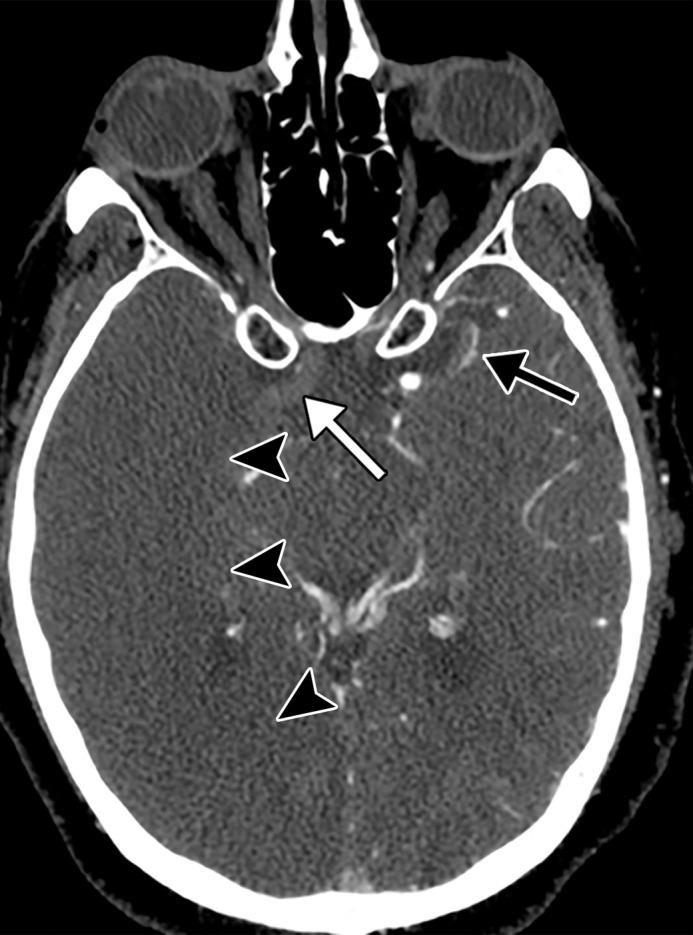 https://cdn.ncbi.nlm.nih.gov/pmc/blobs/3872/7646410/d46376ecd826/rg.2020200195.fig5d.jpg