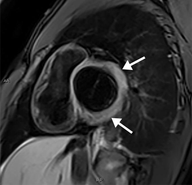 https://cdn.ncbi.nlm.nih.gov/pmc/blobs/3872/7646410/ebbbb33e7f95/rg.2020200195.fig3b.jpg