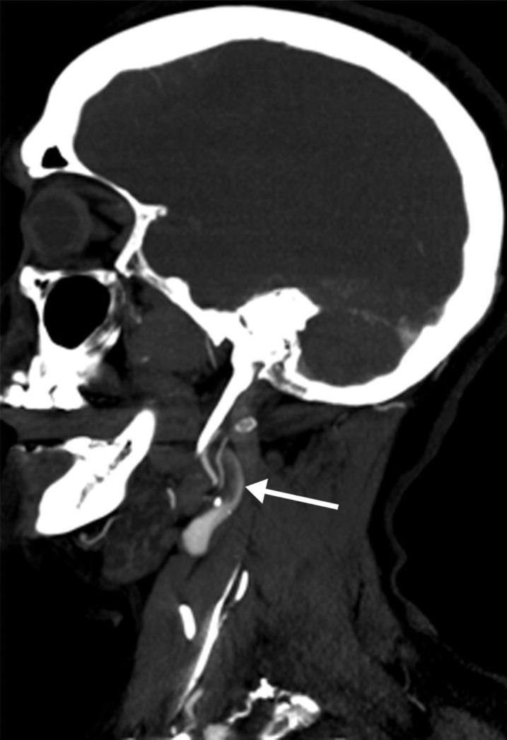 https://cdn.ncbi.nlm.nih.gov/pmc/blobs/3872/7646410/f77c8b0387d1/rg.2020200195.fig5b.jpg