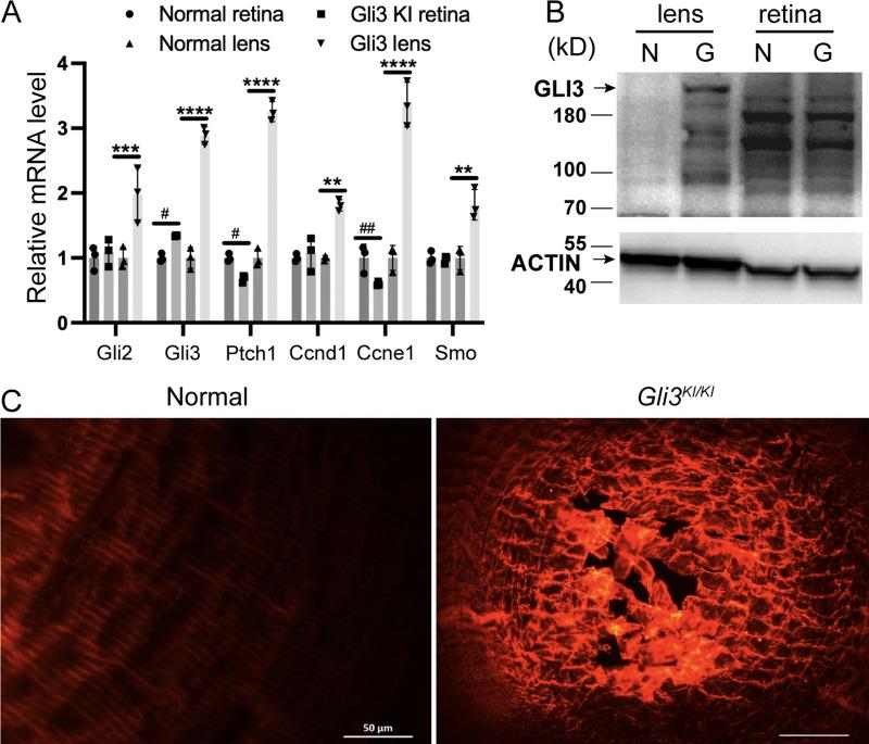 https://cdn.ncbi.nlm.nih.gov/pmc/blobs/3876/467107/71dee457bc76/tvst-13-7-11-f005.jpg