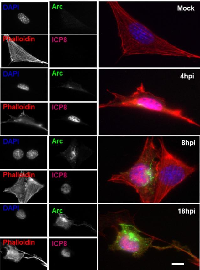 https://cdn.ncbi.nlm.nih.gov/pmc/blobs/3883/6340317/de380d8e7183/fncel-12-00505-g0005.jpg