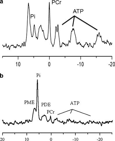 https://cdn.ncbi.nlm.nih.gov/pmc/blobs/3884/3913853/a68957e4f4d5/12975_2013_322_Fig2_HTML.jpg