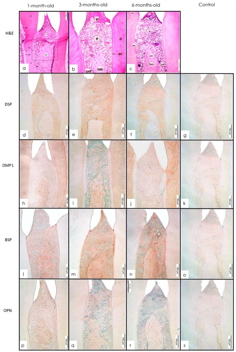 https://cdn.ncbi.nlm.nih.gov/pmc/blobs/3889/9406783/08b65ce6baef/dentistry-10-00144-g003.jpg