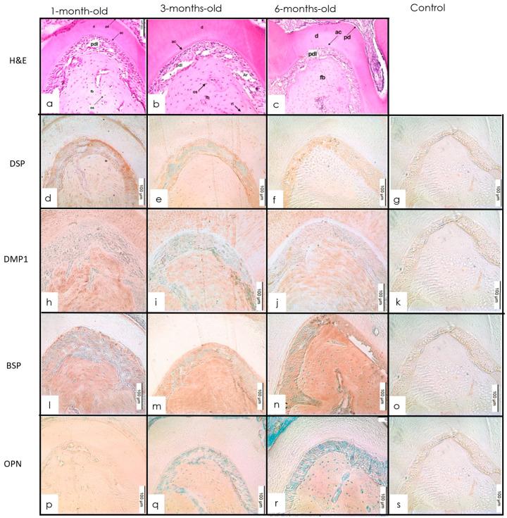 https://cdn.ncbi.nlm.nih.gov/pmc/blobs/3889/9406783/d18aeb8ffbf6/dentistry-10-00144-g004.jpg