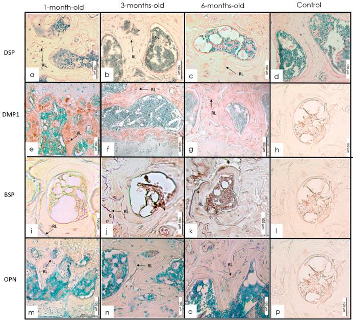 https://cdn.ncbi.nlm.nih.gov/pmc/blobs/3889/9406783/e571c4e6b1bc/dentistry-10-00144-g002.jpg