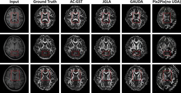 https://cdn.ncbi.nlm.nih.gov/pmc/blobs/388d/10246114/94ccca7ec48d/nihpp-2305.14589v1-f0009.jpg