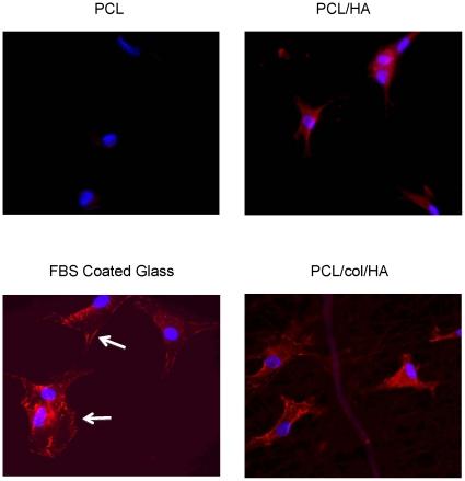 https://cdn.ncbi.nlm.nih.gov/pmc/blobs/388e/3035635/0cd1bedb6a17/pone.0016813.g005.jpg