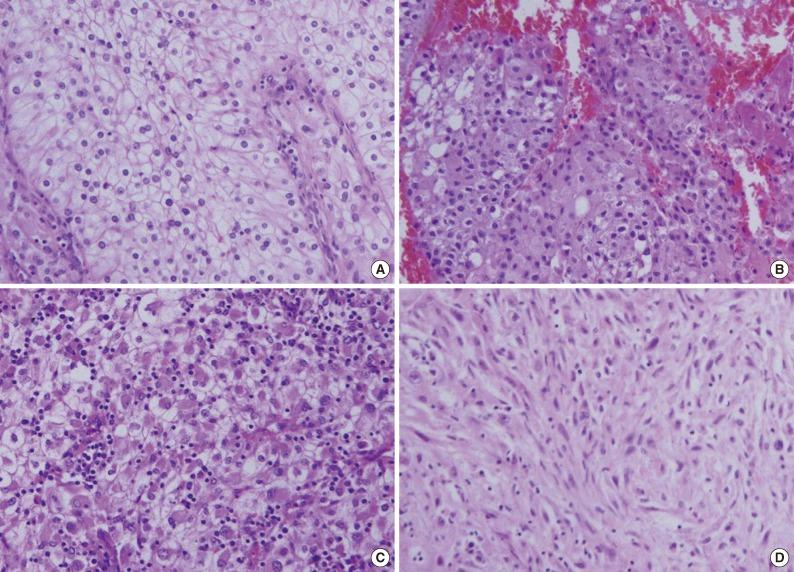 https://cdn.ncbi.nlm.nih.gov/pmc/blobs/3899/3830989/1d05866310ba/kjpathol-47-426-g001.jpg
