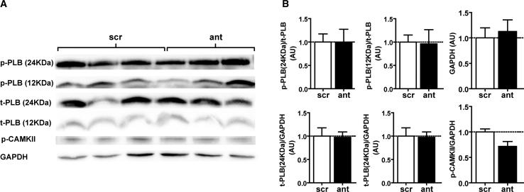 https://cdn.ncbi.nlm.nih.gov/pmc/blobs/389f/6365487/6bc4269aacaa/gr2.jpg