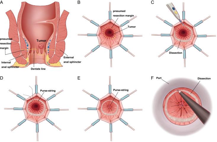 https://cdn.ncbi.nlm.nih.gov/pmc/blobs/38a0/10871607/a19f58c0cf00/js9-110-0709-g003.jpg
