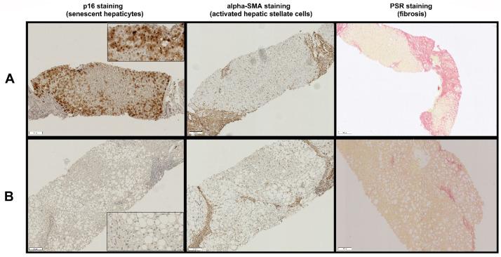 https://cdn.ncbi.nlm.nih.gov/pmc/blobs/38a6/9322633/0b8ee9e523fe/cells-11-02221-g002.jpg
