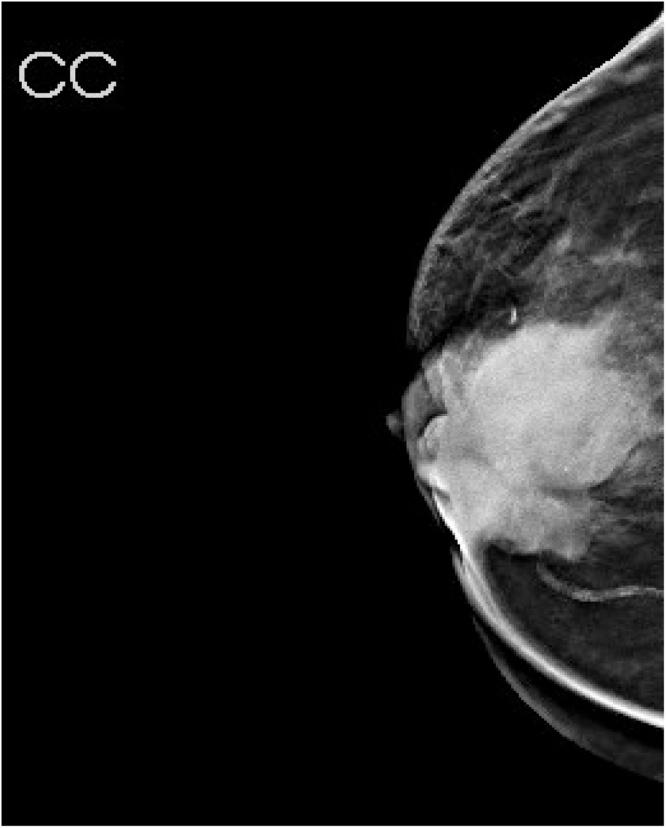 https://cdn.ncbi.nlm.nih.gov/pmc/blobs/38aa/7758454/0e62dd0c396f/gr3.jpg