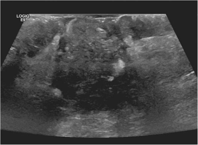 https://cdn.ncbi.nlm.nih.gov/pmc/blobs/38aa/7758454/174415941523/gr2.jpg