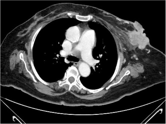 https://cdn.ncbi.nlm.nih.gov/pmc/blobs/38aa/7758454/a933ee9240de/gr4.jpg