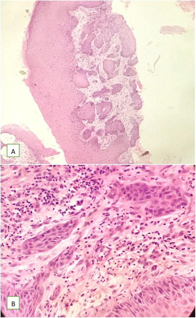 https://cdn.ncbi.nlm.nih.gov/pmc/blobs/38aa/7758454/b35a6cde88c1/gr6.jpg