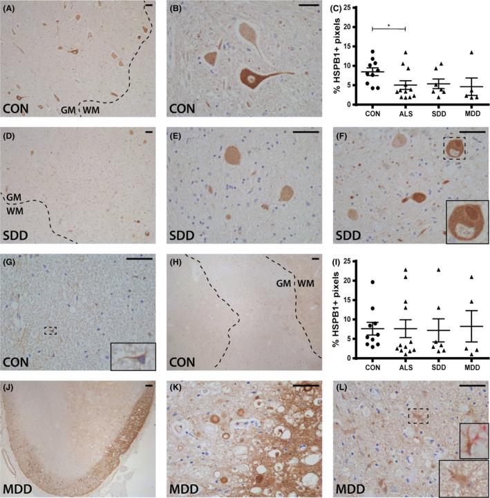 https://cdn.ncbi.nlm.nih.gov/pmc/blobs/38b2/7379307/2fa9a1c69277/NAN-45-459-g003.jpg
