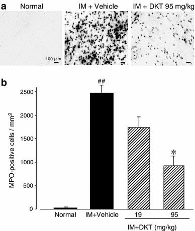 https://cdn.ncbi.nlm.nih.gov/pmc/blobs/38ba/4048467/5fee3b7250bf/535_2013_854_Fig4_HTML.jpg