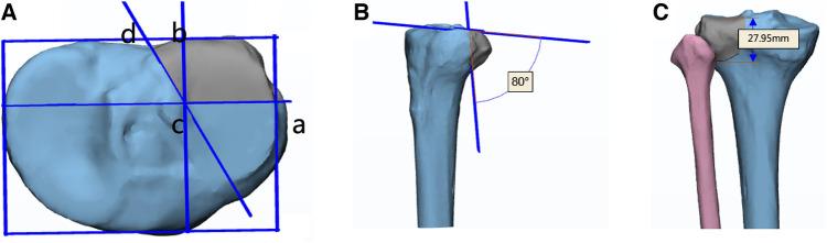 https://cdn.ncbi.nlm.nih.gov/pmc/blobs/38c5/11284072/0f4357b7de52/fsurg-11-1346462-g001.jpg