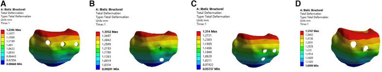 https://cdn.ncbi.nlm.nih.gov/pmc/blobs/38c5/11284072/be42d25a654b/fsurg-11-1346462-g003.jpg