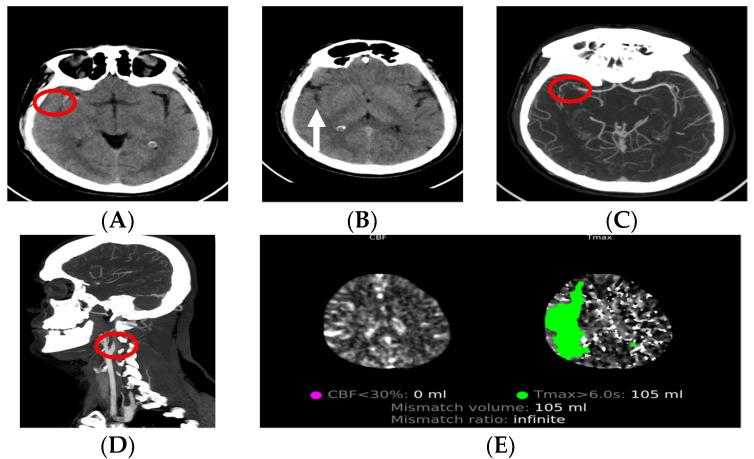 https://cdn.ncbi.nlm.nih.gov/pmc/blobs/38c7/10673396/11b4caa21107/medicina-59-01908-g002.jpg
