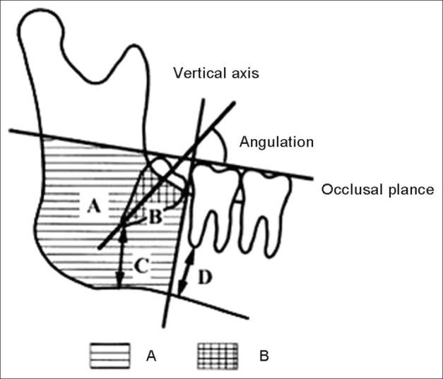 https://cdn.ncbi.nlm.nih.gov/pmc/blobs/38cb/4023186/8dea6bb93a14/EJD-7-212-g004.jpg