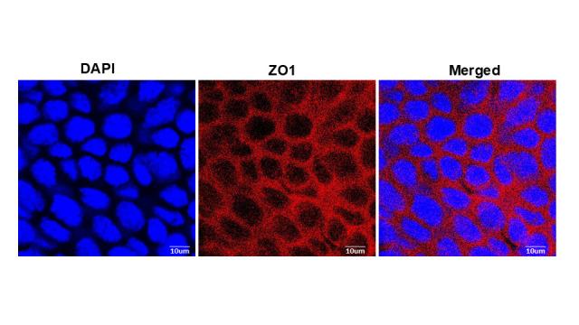 https://cdn.ncbi.nlm.nih.gov/pmc/blobs/38cf/12086347/d752c7ec81b8/BioProtoc-15-6-5249-g007.jpg