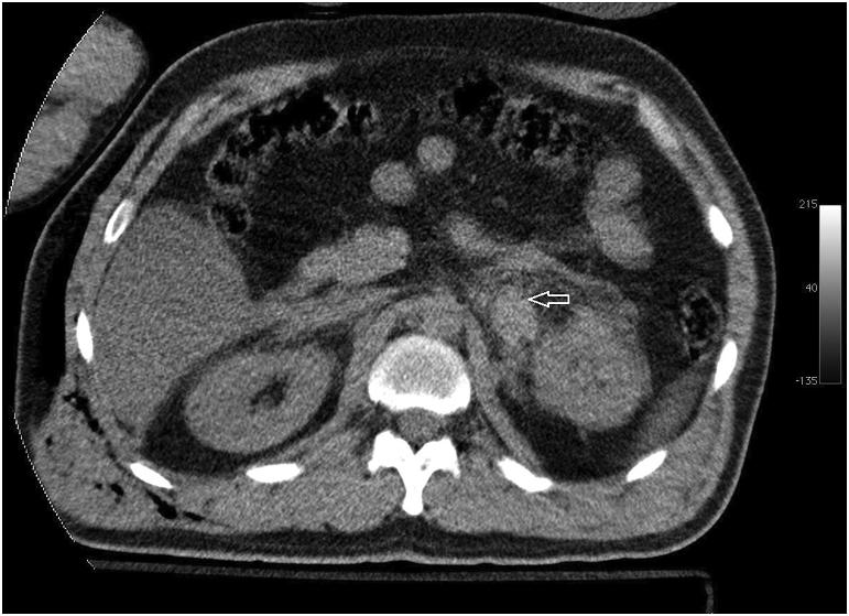 https://cdn.ncbi.nlm.nih.gov/pmc/blobs/38d2/5343102/06f21aa5ef0d/gr4.jpg