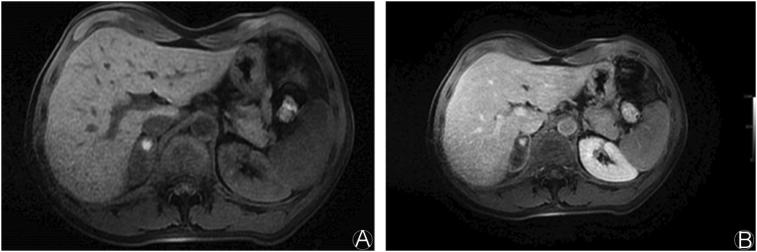 https://cdn.ncbi.nlm.nih.gov/pmc/blobs/38d2/5343102/9562843fde23/gr2.jpg
