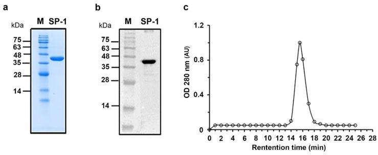 https://cdn.ncbi.nlm.nih.gov/pmc/blobs/38d5/8534766/32be333e7743/cells-10-02658-g002.jpg