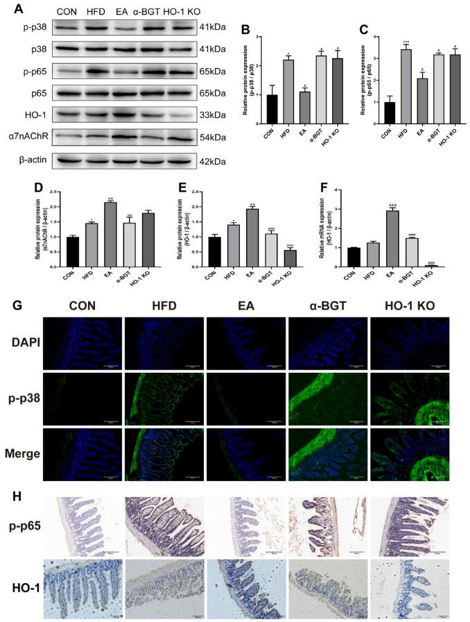 https://cdn.ncbi.nlm.nih.gov/pmc/blobs/38dd/12024594/cfb6dd63488b/biomedicines-13-00802-g007.jpg