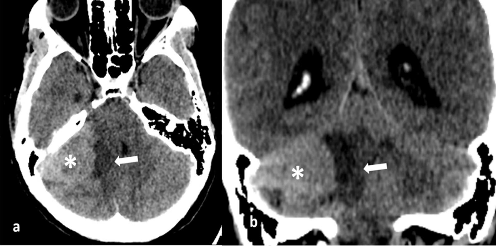https://cdn.ncbi.nlm.nih.gov/pmc/blobs/38dd/9389690/b0d8dc3a1c75/13256_2022_3553_Fig1_HTML.jpg