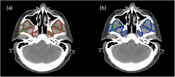 https://cdn.ncbi.nlm.nih.gov/pmc/blobs/38e3/7372849/6265f0eff141/13014_2020_1617_Fig1_HTML.jpg